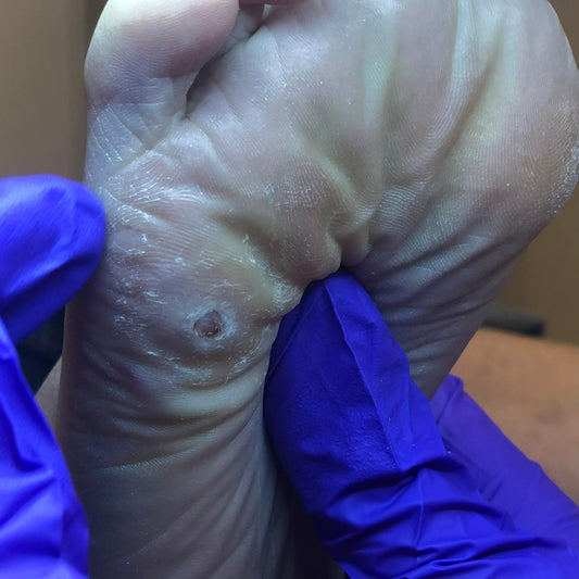 Pasient case nr1.