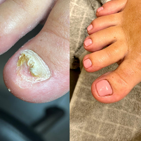 Pasient case nr2.
